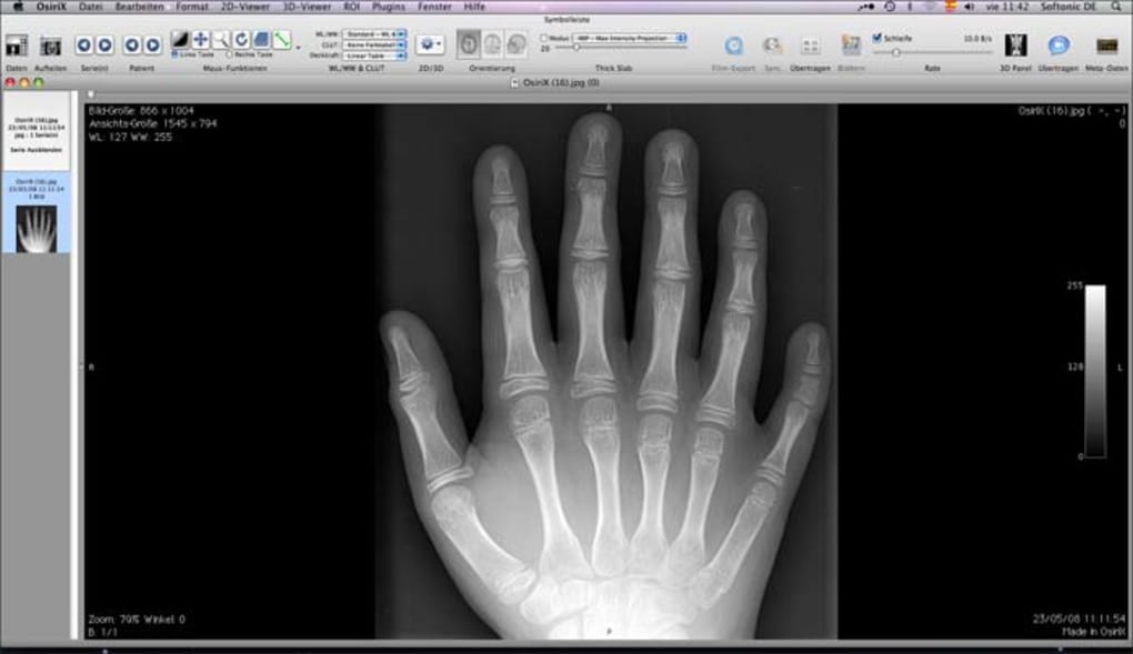 osirix free download for pc